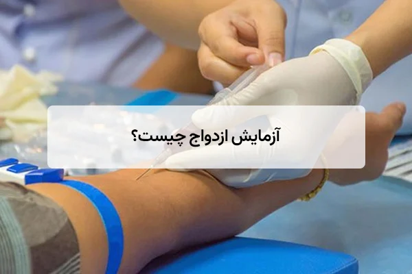 آزمایش ازدواج چیست؟ مراحل، هزینه و نکات کلیدی ۱۴۰۴